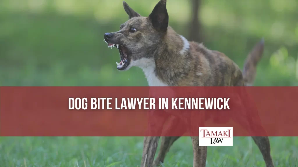 DOG BITE LAWYER IN KENNEWICK